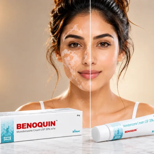 Benoquin Monobenzone Cream USP 20% w/w 30g in Dubai