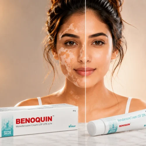 ChatGPT-Image-Jun-26-2026-04_34_36-PM Benoquin Monobenzone Cream USP 20% w/w 30g in Dubai