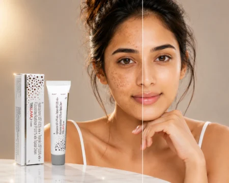 Tri-Luma Cream 15g – Hydroquinone, Tretinoin & Fluocinolone Acetonide in Dubai