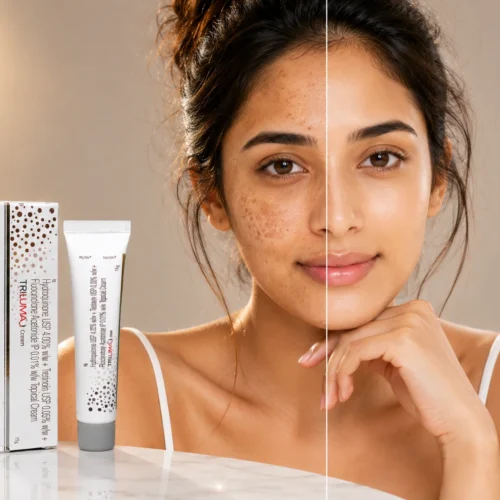 Tri-Luma Cream 15g – Hydroquinone, Tretinoin & Fluocinolone Acetonide in Dubai